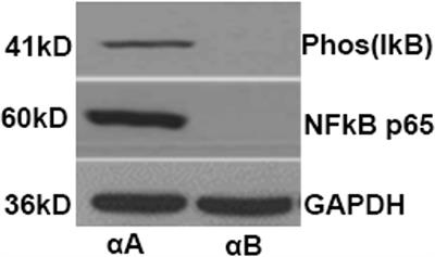 microRNA 146a ameliorates retinal damage in experimental autoimmune uveitis